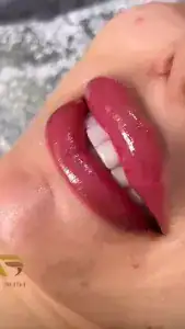 سالن روچ — نمونه 4