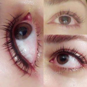 سالن زیبایی رز آبی — نمونه 5