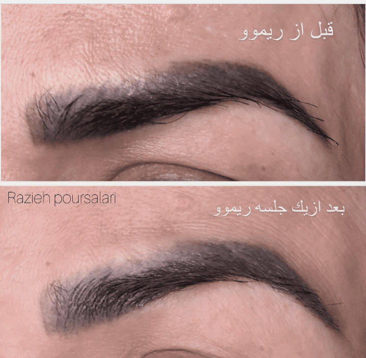راضیه پورسالاری