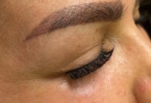 نمونه‌کارها کاشت مژه رها، تصویر 2