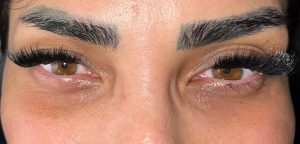نمونه‌کارها کاشت مژه رها، تصویر 6