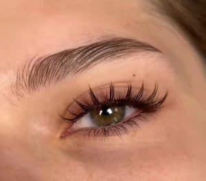 نمونه‌کارها کاشت مژه رها، تصویر 1