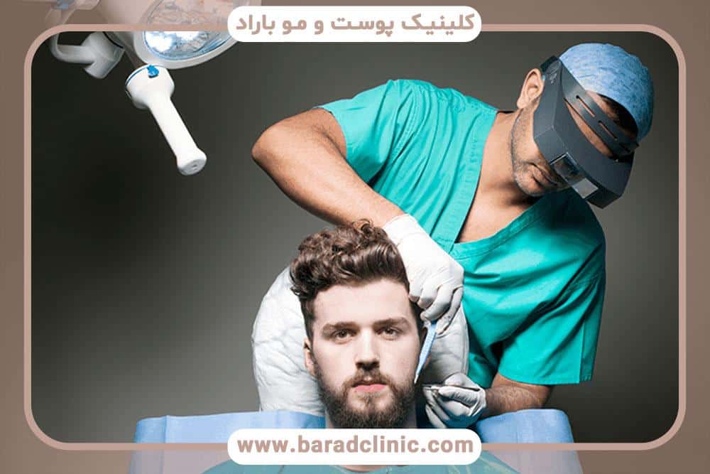 کاشت ریش و سبیل