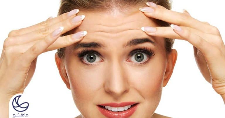 همهچیز درباره بوتاکس پیشانی: روشها، مزایا و نکات مهم