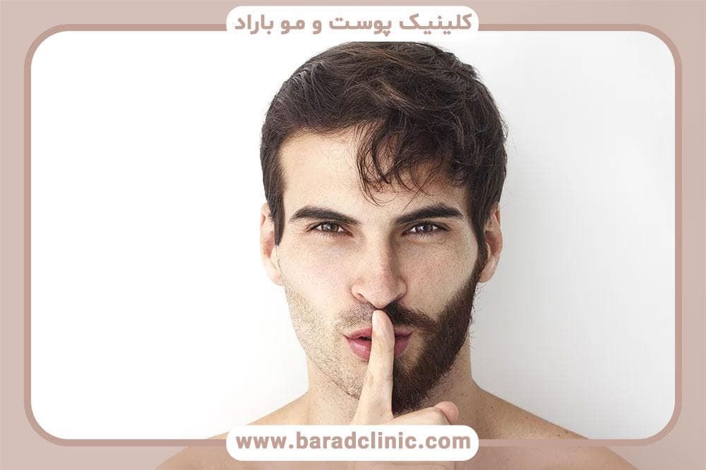 کاشت ریش و سبیل