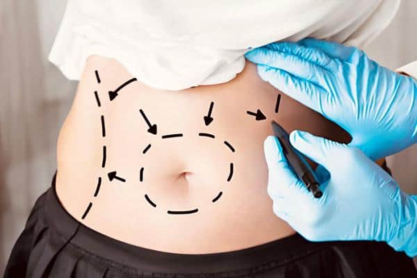 چند روز بعد از ابدو میتوان صاف راه رفت؟ چند روز بعد از ابدو میتوان صاف راه رفت