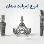 معرفی جامع انواع ایمپلنت دندان