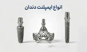 معرفی جامع انواع ایمپلنت دندان