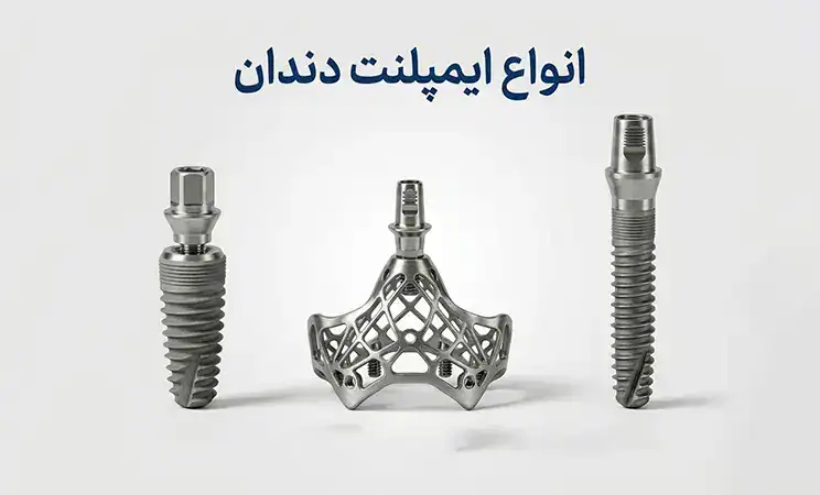 معرفی جامع انواع ایمپلنت دندان