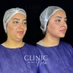مجموعه زیبایی نیرا