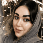 زهره باقری | لیفت مژه