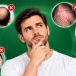 چه کسانی نباید کاشت مو انجام دهند؟