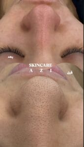 نمونه‌کارها مرکز تخصصی اسکین کر آزی — تصویر 5
