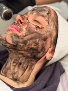 نمونه‌کارها مرکز تخصصی اسکین کر آزی — تصویر 2
