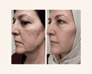 نمونه‌کارها کلینیک زیبایی لمون، تصویر 5