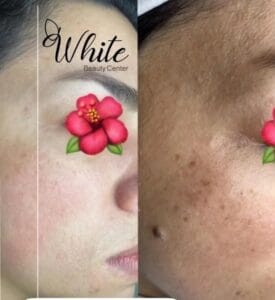 نمونه‌کارها کلینیک زیبایی وایت، تصویر 5