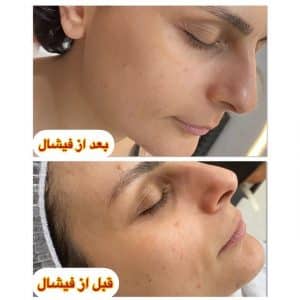 نمونه‌کارها پاکسازی پوست هنگامه مینایی، تصویر 2