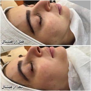 نمونه‌کارها پاکسازی پوست هنگامه مینایی، تصویر 3