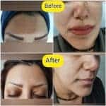 خدمات پاکسازی پوست و فیشیال تخصصی منلی