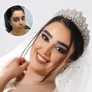 سالن شکیلان — نمونه 3