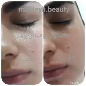 سالن ماه لیلی — نمونه 1