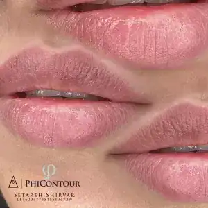 نمونه‌کارها ستاره شیروار، تصویر 6