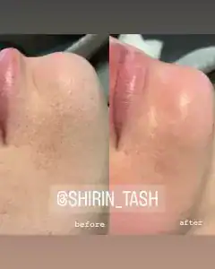آکادمی تاش — نمونه 2