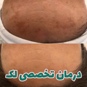آکادمی مونیکادمی — نمونه 2