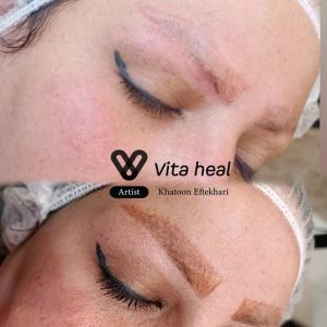 آکادمی ویتاهیل — نمونه 4