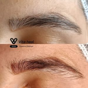 آکادمی ویتاهیل — نمونه 2