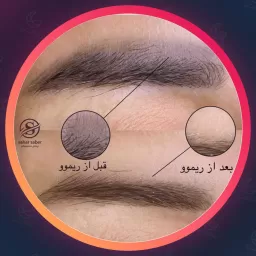 سحر صابر | ابرو در اصفهان