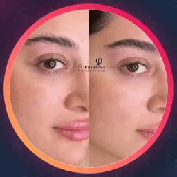نفیسه طوسی | متخصص زیبایی در مشهد